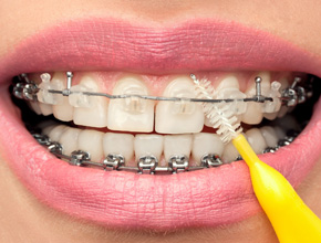 Stomatološki centar - Ortodontsko-hirurška terapija